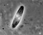 Myxobolus_spinacurvatura