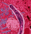 malaria plasmodium